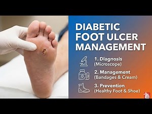 Diabetic Foot Ulcer Management: Complete Clinical Guide (Diagnosis to Prevention)