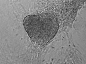 Generation of Human Cardiomyocytes: A Differentiation Protocol from Feeder-free Human Induced Pluripotent Stem Cells