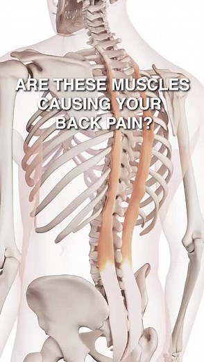 Are The Multifidi and Rotatores Causing Your Back Pain? 👉 The multifidi and rotatores are two groups of muscles located in the back, close to the spine. They play an important role in stabilizing and rotating the spine. 👉 Trigger points in the multifidi and rotatores can cause pain in the lower back, hips, buttocks, and shoulders. 👉 Treatment for trigger points in the multifidi and rotatores may include massage, dry needling, acupuncture, stretching, and strengthening exercises. The multifidi
