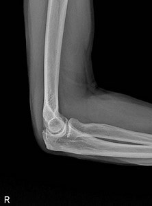 ASPEN AiRTouch Compact Portable Handheld X-Ray Machine