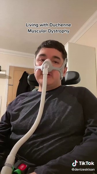 Understanding Duchenne Muscular Dystrophy: Life Expectancy and Awareness