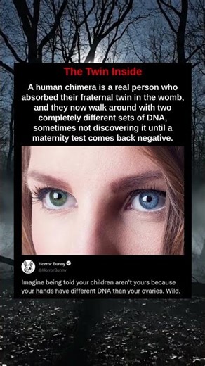 A human chimera is a real person who absorbed their fraternal twin in the womb, and they now walk