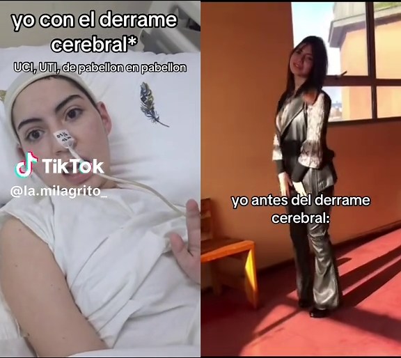 #dúo con @la.milagrito_ mi psicologo dice q deje de compararme con la Paloma de antes, q me compare con la Paloma q estuvo en la UCI #derramecerebral