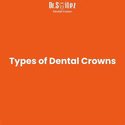 Dental crowns are tooth-shaped caps that restore decayed, broken, weak or worn-down teeth.🦷 Choose the ideal dental crown for yourself from various options. ⭐ #dentalcrowns #types #drsmilez #Benefits #oralhygiene #dentalhealth #options | Dr. Smilez Group of Dental Centers
