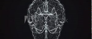 Animation of a brain scan screen from different angles. Digital scan. MRI 4K video