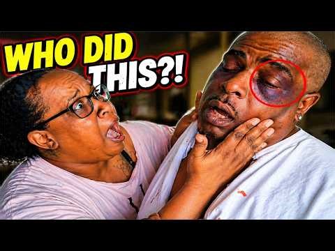 I Came Home With A Black Eye… My Fiancé Went OFF! 😳
