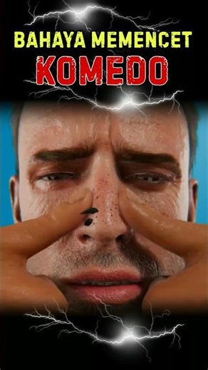 The Dangers of Squeezing Blackheads.