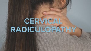 Understanding Cervical Radiculopathy