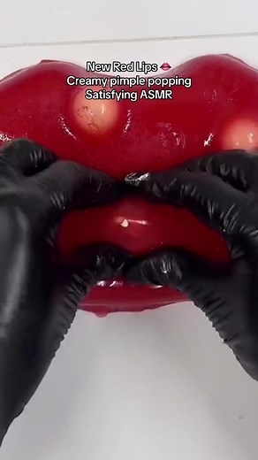 We need kiss clear of pimples #lips #redlips #biglips #longervideos #foryou #npc #fypシ゚viral🖤tiktok #CapCut #asmr #satisfying #us #viral #mochipimplepopping #pimplepoppin