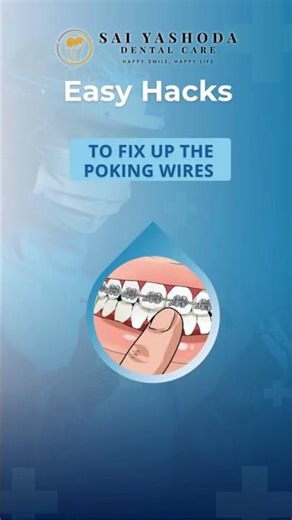 Easy Hacks to Fix Poking Braces Wires | Orthodontic Tips by Indian Orthodontic Society