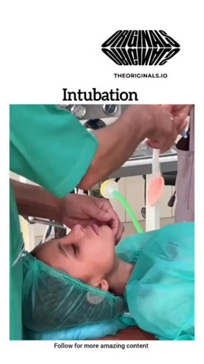 Ak Nursing Academy on Instagram: "Intubation is a medical procedure to insert a tube into the body to maintain an open airway, typically by placing a tube through the mouth or nose into the trachea (windpipe). It is performed to help a person breathe when they are unable to do so on their own, such as during surgery, in an emergency, or due to respiratory failure. . . . Only for education purpose. Contact us for remove or credit. . . . . Follow @ak_nursing_academy_ . . . #aknursingacademy #nursi