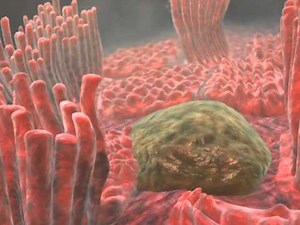 Medical Animation: Microvilli