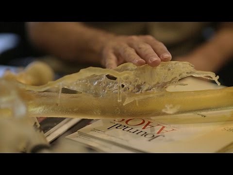 Heterotopic Ossification Research