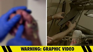 'Cake Boss' Buddy Valastro Shows Off First Look at Impaled Hand