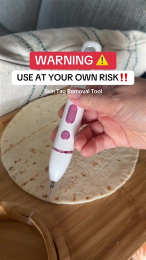 Effective Skin Tag Removal with the Beauty Pen