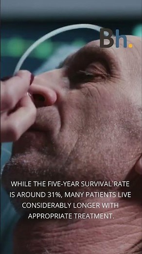 How Long Can You Live With Stage 4 Prostate Cancer?
