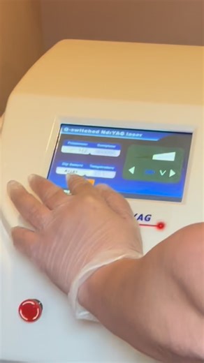  Do it now, regret it later? Erase your regrets with the Q-Switched...