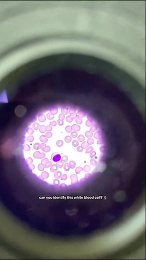 Blood film 😍🥰 #lablife #hematology #medicallaboratoryscience | Lab life