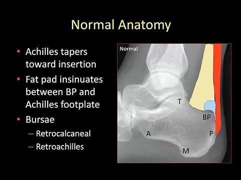 Emory MSK E-Lecture Series - Dr. Hilary Umans.