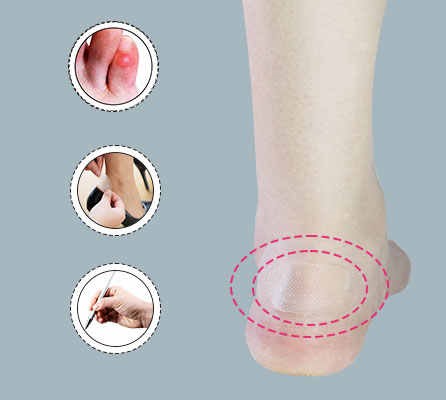 Portable Modern Transparent Hydrogel Wound Dressing Advanced Care for Wound Healing