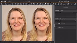 Align Technology | ✨ Enter a new era of smile visualization with ClinCheck® Smile Video ✨ Designed to help doctors communicate treatment plans more... | Instagram
