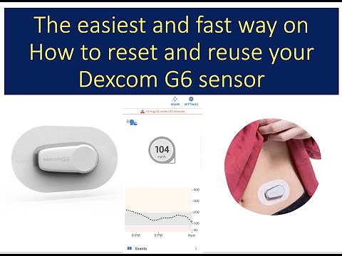 2021 easiest way to restart, reset, reuse Dexcom G6 sensor [UPDATED]