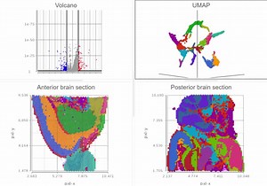 Visium analysis in Partek Flow | Alison Hargreaves