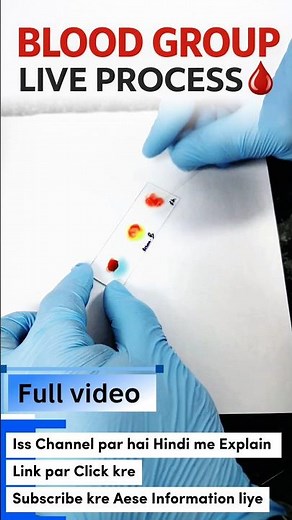 Blood Group Test | Live Process 🩸(Educational Video)#BloodGroup#BloodGroupTest#BloodGrouping