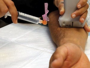 Common Forearm Nerve Blocks