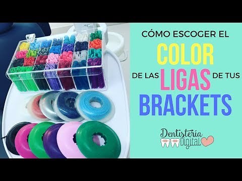 CÓMO ESCOGER EL COLOR DE LAS LIGAS DE TUS BRACKETS / How to choose the color of your braces