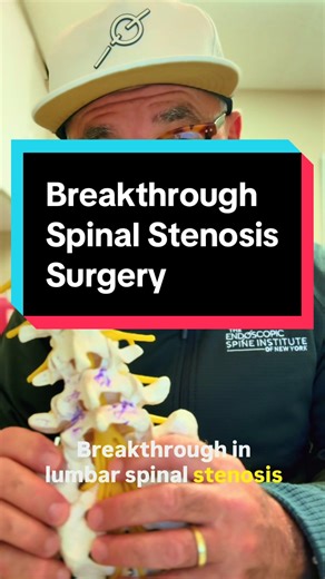 Breakthrough lumbar spinal stenosis surgery #LumbarStenosis #BackPain #Stenosis #SpinalStenosis #Spine
