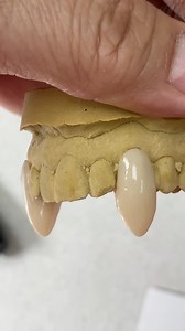 25K views · 140 reactions | Custom acryGrip Partial with vampire fangs! Case from Dr. Robert McGonigle in Illinois! McGonigle Dental Associates | Luke Kahng | Facebook