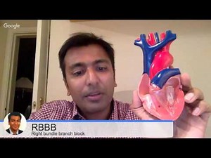 RBBB - right bundle branch block