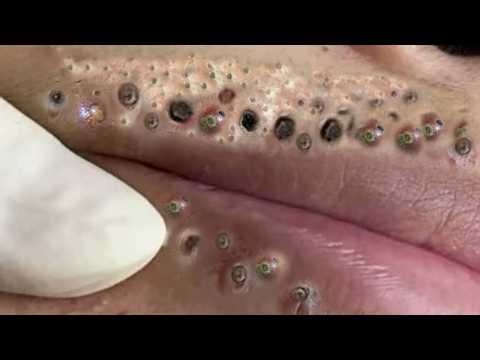 𝑅𝑒𝑐𝑙𝑎𝑖𝑚 𝑌𝑜𝑢𝑟 𝐺𝑙𝑜𝑤 𝐴𝑛𝑑 𝐶𝑎𝑙𝑚 𝑇ℎ𝑟𝑜𝑢𝑔ℎ 𝑀𝑖𝑛𝑑𝑓𝑢𝑙 𝑆𝑘𝑖𝑛𝑐𝑎𝑟𝑒 𝑀𝑜𝑚𝑒𝑛𝑡𝑠| 𝐷𝑒𝑒𝑝 𝐶𝑙𝑒𝑎𝑛𝑠𝑖𝑛𝑔 & 𝑆𝑜𝑜𝑡ℎ𝑖𝑛𝑔 𝑀𝑎𝑠𝑠𝑎𝑔𝑒 #9026