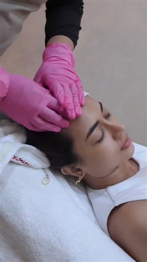 Target pigmentation, smooth acne scars, and even out skin tone with PicoSure Pro — the world’s leading picosecond laser for radiant, youthful skin. | The Aura Ruz Timog Branch | Facebook