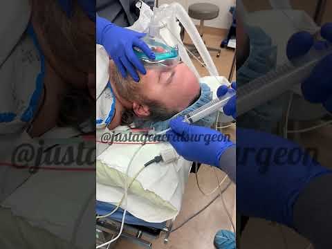 Inside the OR with ‪@justageneralsurgeon‬ - putting a patient to sleep from start to finish anesthesia