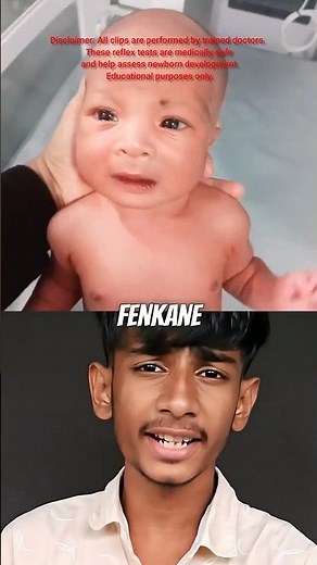 Why Doctors Do A Quick Reflex Test On Babys 👶🏻 (EXPLAINED)