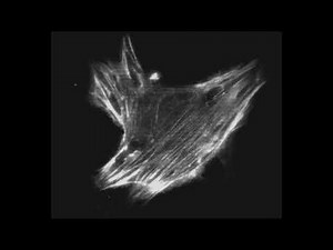 Activation of Rho-kinase and focal adhesion kinase regulates the organization of stress fibers