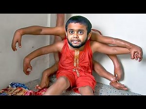 15 Most Unusual Human Body Parts Found in India