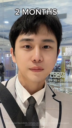 TikTok의 viewplasticsurgery_indo