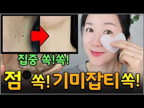 어느날 생긴 점●'◡'색소침착 잡티,검버섯 완전 쏙쏙! OO팩 집에서 직접 해보세요!