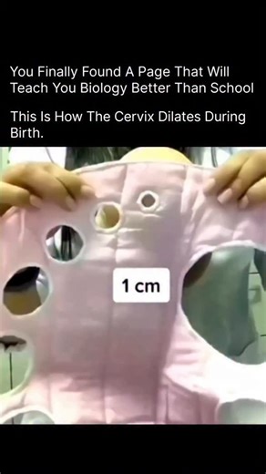HEALTH | MEDICAL | BIOLOGY on Instagram: "During normal vaginal delivery, the cervix (mouth of the uterus) slowly opens from 1 cm to 10 cm, which is called cervical dilation. From 1–3 cm, the cervix starts softening and opening, and contractions are usually mild and irregular (early labor). From 4–7 cm, this is active labor—contractions become stronger, closer together, and the cervix opens faster. From 8–10 cm, called the transition phase, contractions are very strong and intense, and the cervi