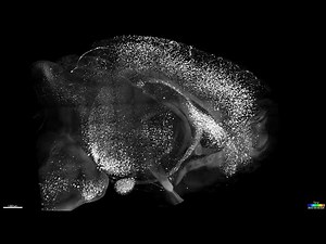 Whole-brain imaging of β-Amyloid staining with tissue clearing techniques