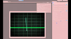 Electrocardiogram (ECG/EKG) Traces