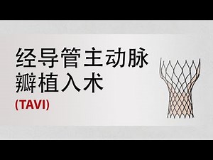 经导管主动脉瓣植入术 (TAVI)