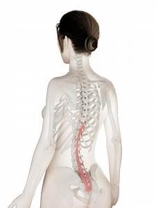 Pain after spinal fusion may be from post-surgical muscle damage