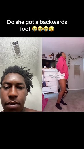 #duet with @Lyris :)) #rotationplasty