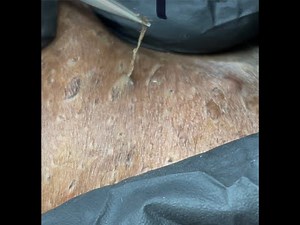 Extraction Brazilian Area (2 wigs)