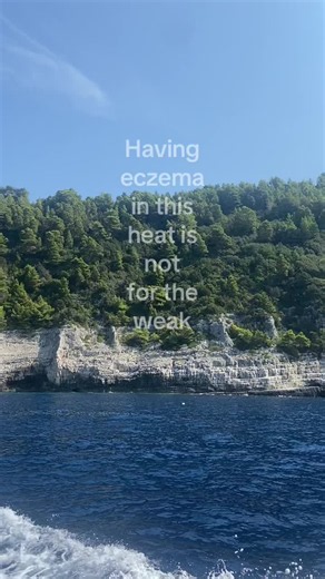 Eczema in Summer Heat: Tips for Immediate Relief