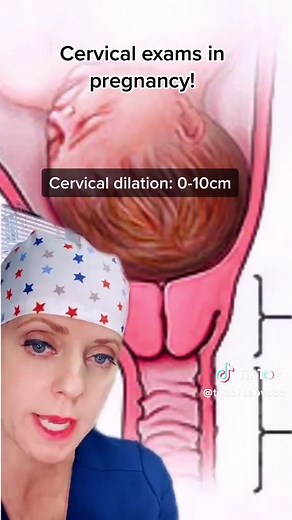 Basics of the cervical exam! #obgyn #mfm #cervix #cervicalexam #cervixcheck #cervicaldilation #birth #childbirth #laboranddelivery